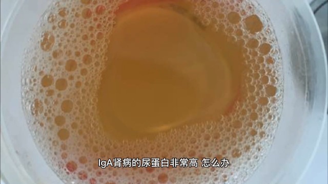 iga肾病的尿蛋白非常高,怎么办?