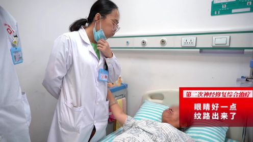 面瘫一般多久恢复正常？广州和谐医院神经修复案例分享—于女士