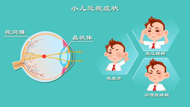 50%的小学生近视,天价眼镜值不值?护眼灯还是害眼灯?儿童近视怎么治,全是坑!