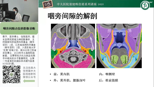 声门旁间隙图片