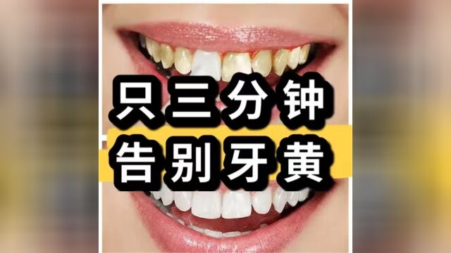 怎么才能去除黄牙?过来人白牙的方法一定要收藏好!