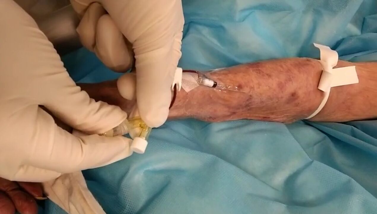 留置针是否成功置入,拧肝素帽就能判断?