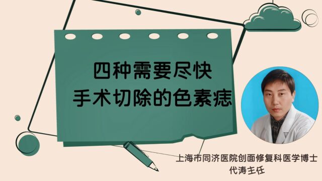 四种需要尽快手术切除的色素痣