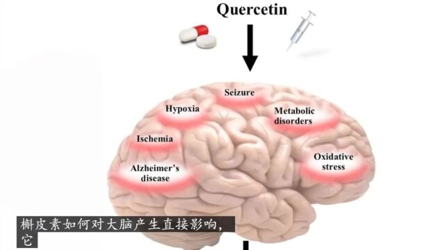 我终结AD(阿尔茨海默病)的秘密武器与淀粉样斑块无关|卢卡斯ⷥ奦退