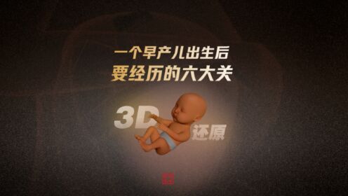 3D真实还原早产儿出生后的六重难关丨国际早产儿日