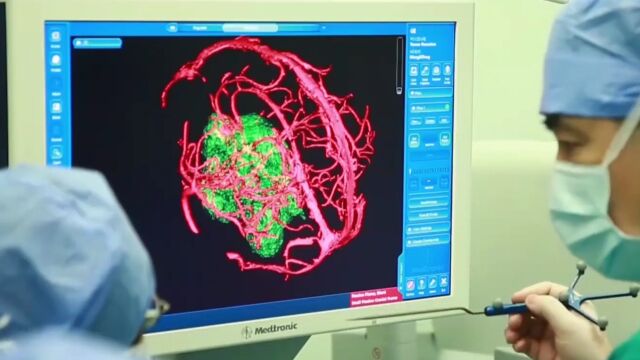 她的手术,将用到目前世界上,最为先进的神经导航系统