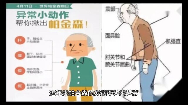 帕金森日常护理措施