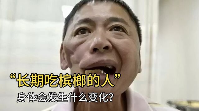 长期吃槟榔的人,身体会发生什么变化?医生终于说出答案!