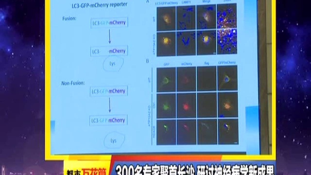 300名专家聚首长沙 研讨神经病学新成果