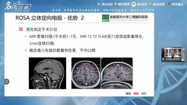 《名医大讲堂》403期 关宇光 儿童癫痫该如何治疗?