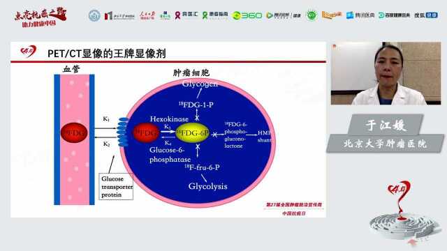 PET/CT显像的王牌显像剂