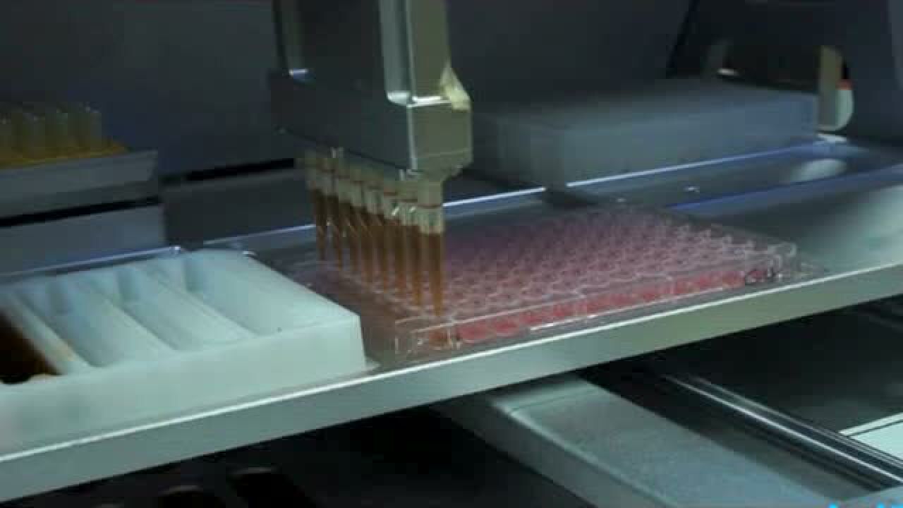 智能全自动移液工作站血凝实验_高清1080P在线观看平台_腾讯视频