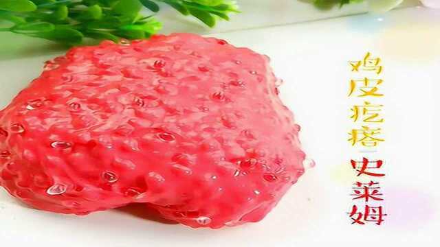 手臂上长红色鸡皮疙瘩(手臂上长红色鸡皮疙瘩怎么回事) 手臂上长红色鸡皮疙瘩(手臂上长红色鸡皮疙瘩怎么回事)