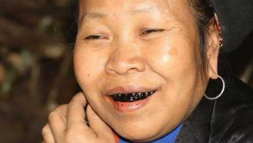 云南某部落妇女满口黑牙专家造访被吓坏黑牙背后的秘密竟然是