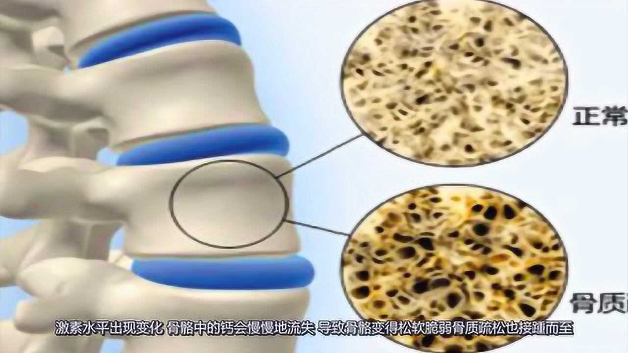 缺钙有哪些表现?出现这三种情况要注意了,可能是你的身体要补充钙_高清1080P在线观看平台_腾讯视频