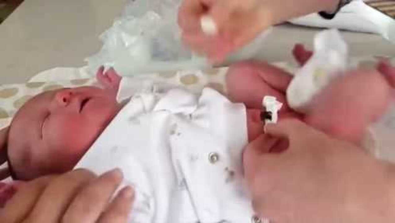 看国外医生是如何清理新生儿宝宝肚脐的，这才够专业！_腾讯视频