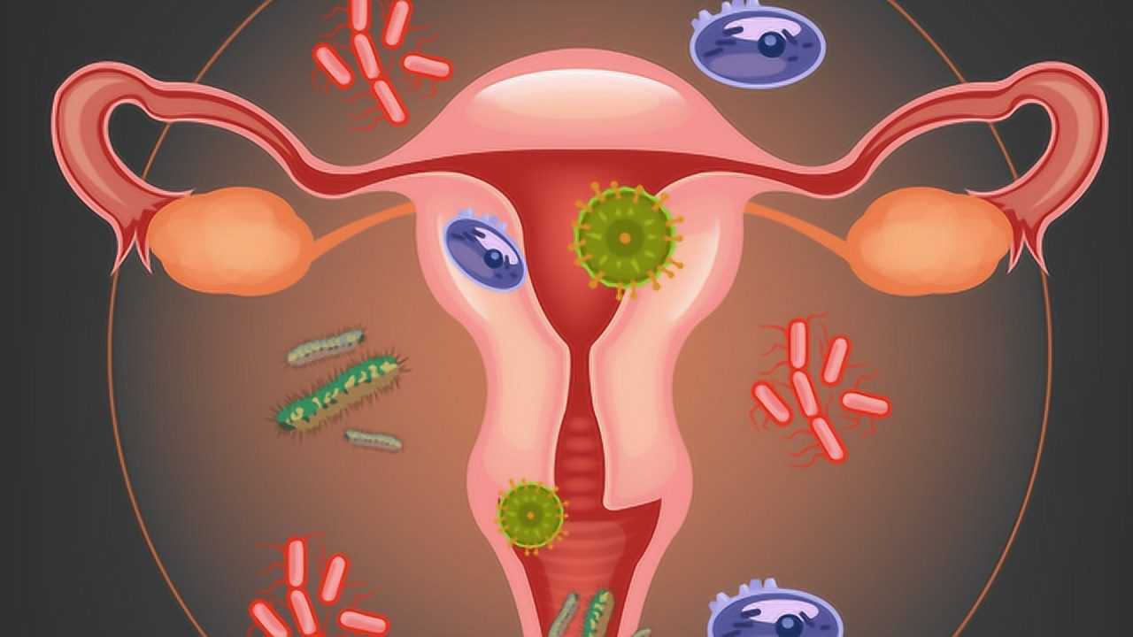 女人得了慢性宫颈炎要注意什么?医生给出了具体答案