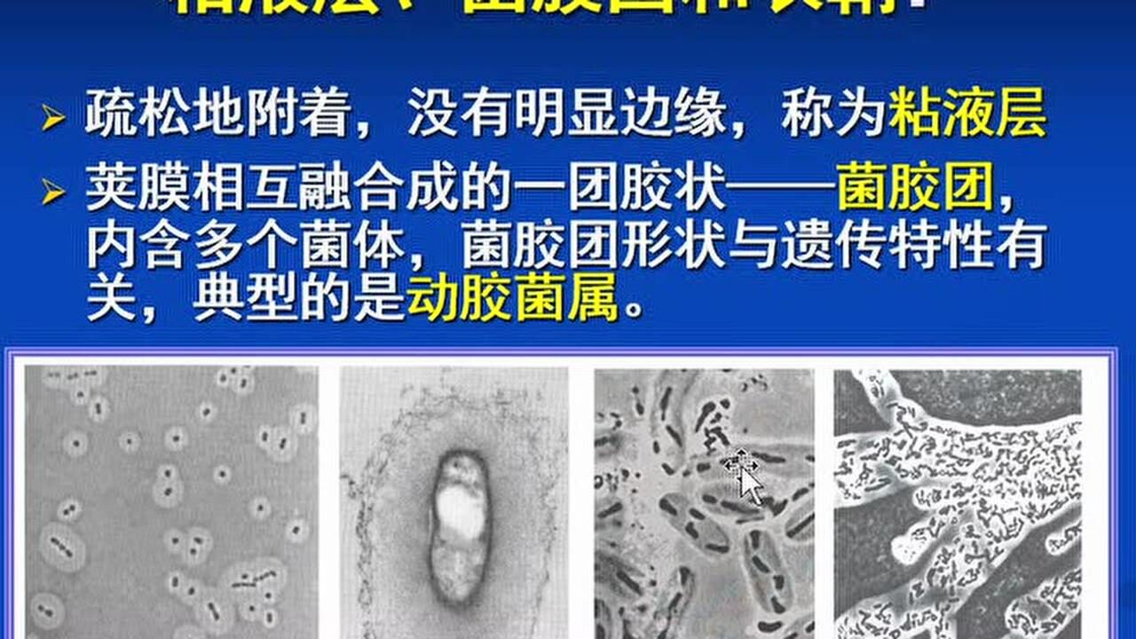 荚膜的构成与功能及分类_高清1080P在线观看平台_腾讯视频