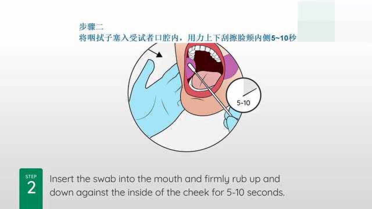 口腔咽拭子采样_腾讯视频