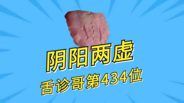 舌诊哥:舌诊系列第434位,阴阳两虚,药物只能辅助,重点是调理