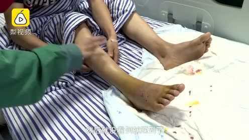 17岁少年湘江边散步，被五步蛇窜出咬伤：视力模糊进ICU