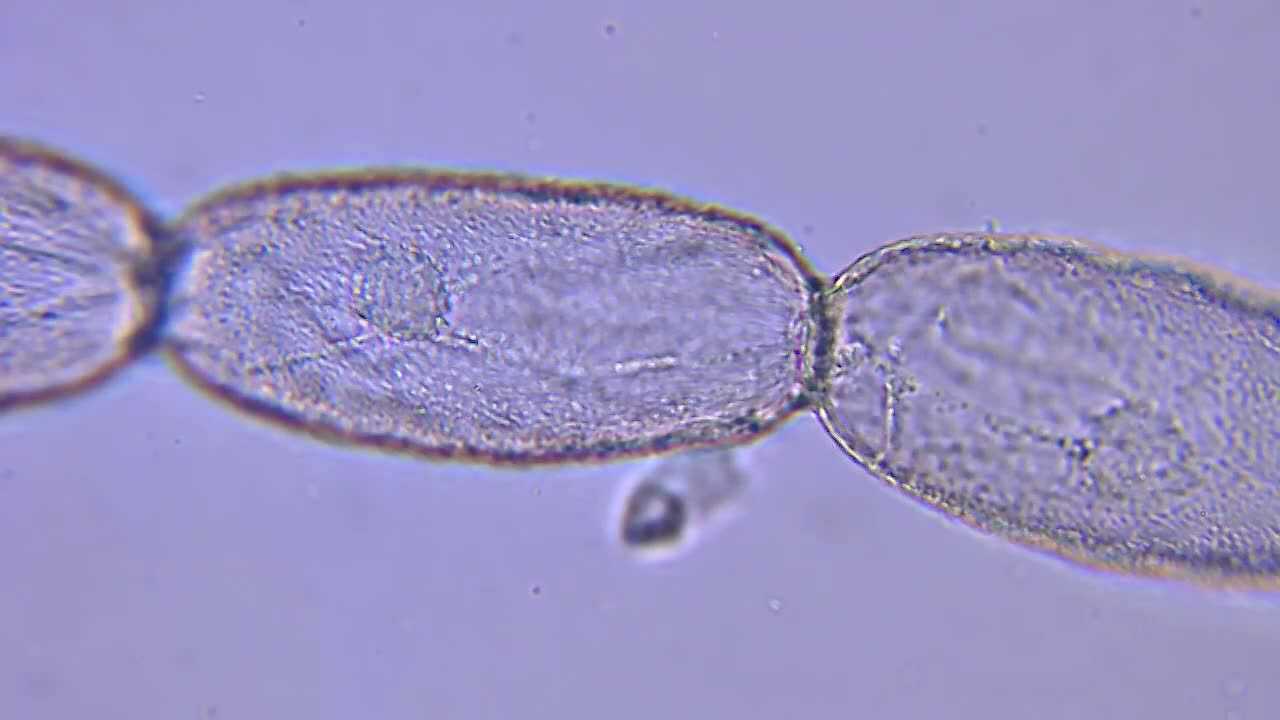 紫鸭跖草细胞图图片