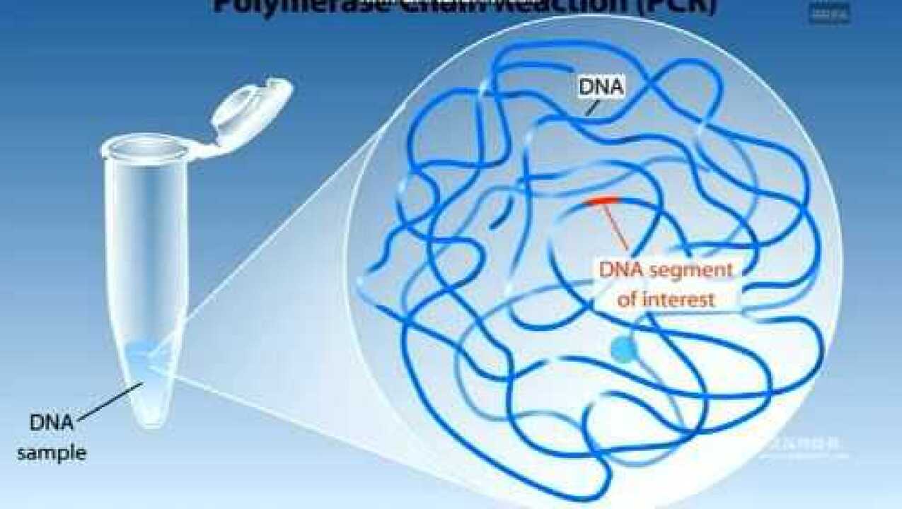 PCR扩增技术原理_高清1080P在线观看平台_腾讯视频