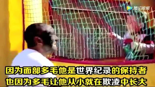 他是世界第一“狼人” 只因为这张独特的脸