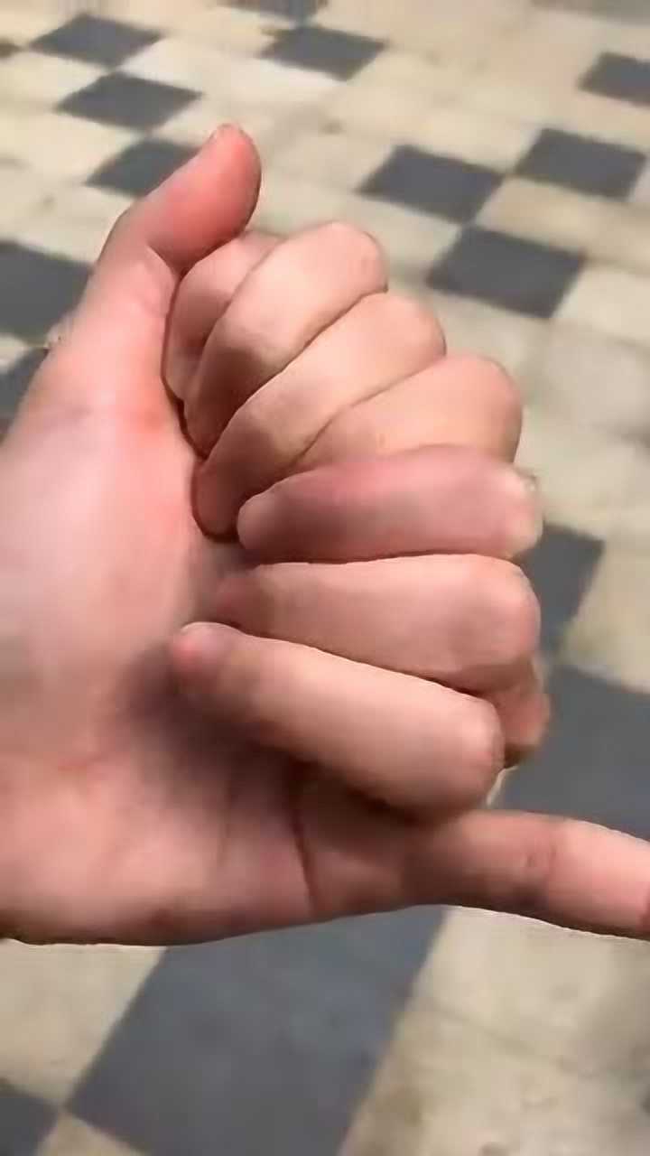 从小长了八根手指头我太特别了