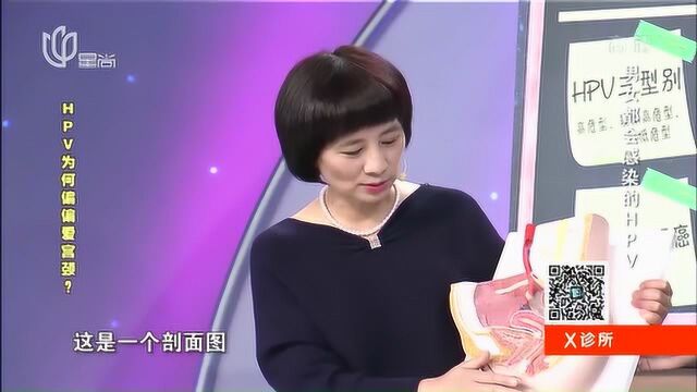 为何HPV偏爱宫颈癌?现场演示,宫颈病变的关系