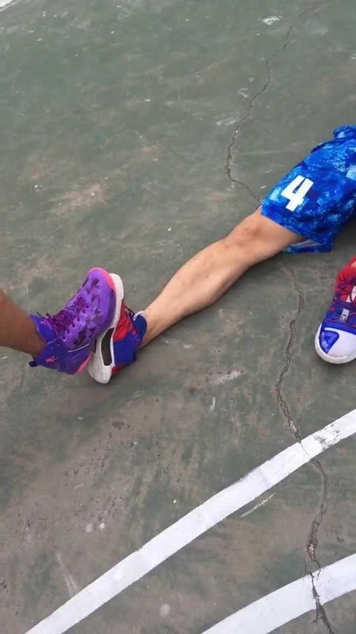 运动过量,小腿抽筋,这筋给抽的真是吓人啊!