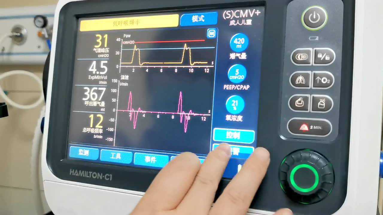 哈美顿呼吸机的使用_腾讯视频