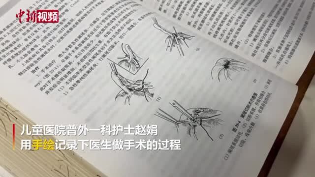 护士手绘100幅儿童手术图方便给家长讲解