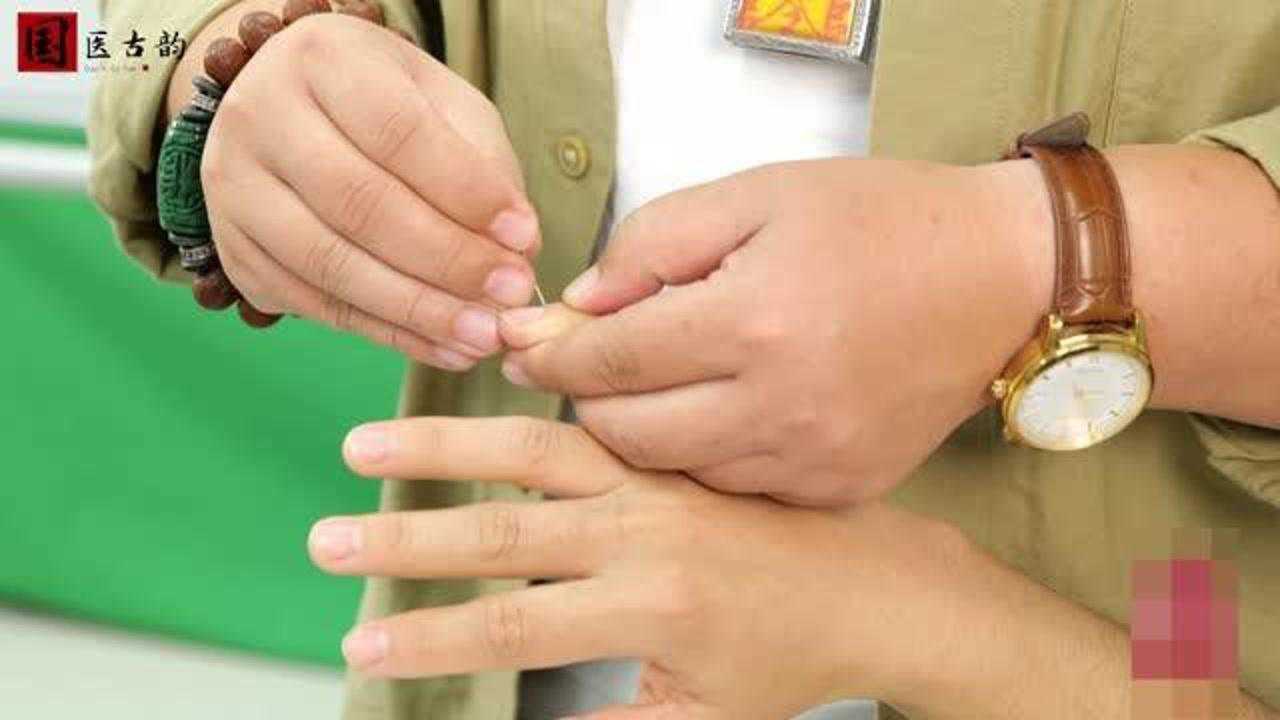 董氏奇穴:关节炎 膝盖疼 中医针灸"火膝穴"帮你快速缓解膝关节疼痛!
