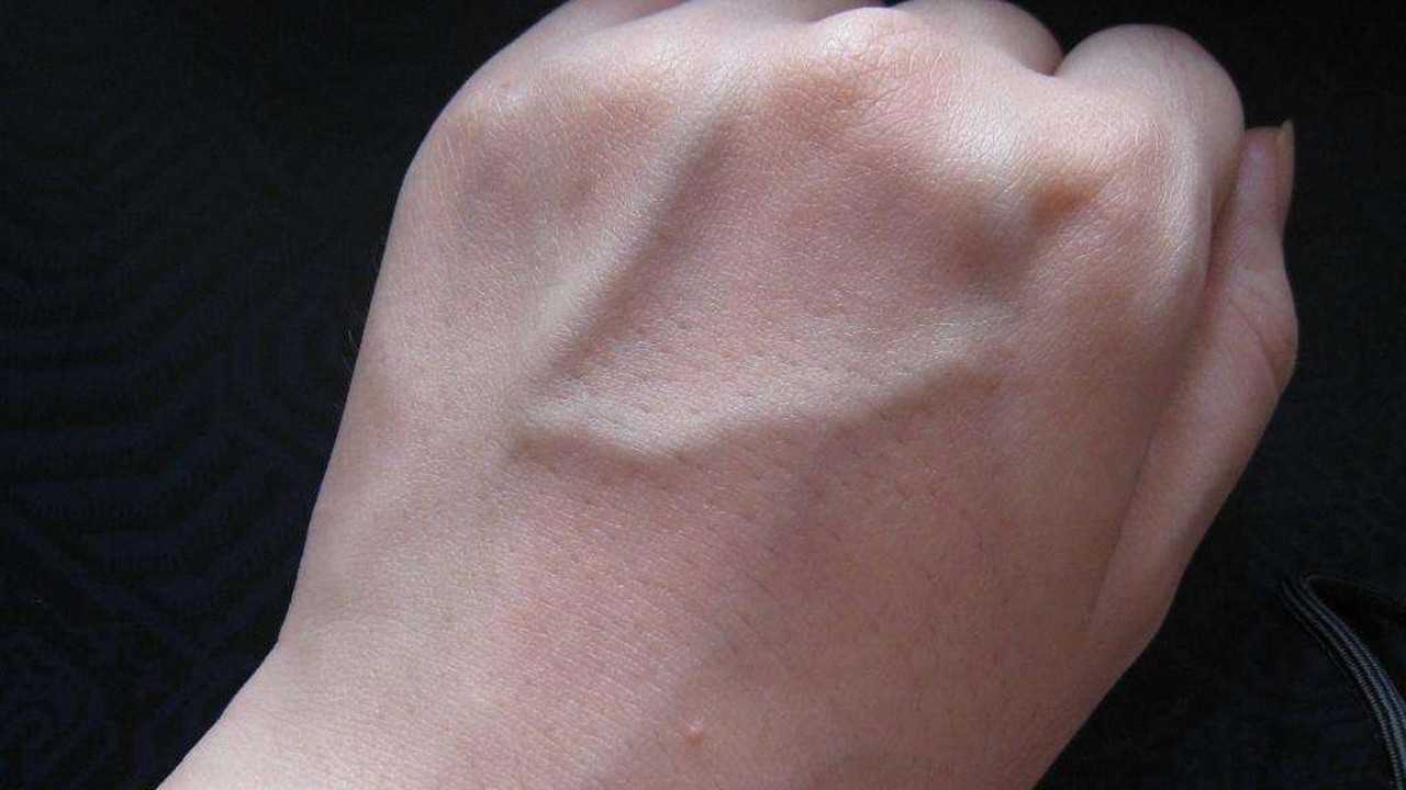 手背有青筋,竟然是这个部位出现了问题!身上有青筋的人都要小心了