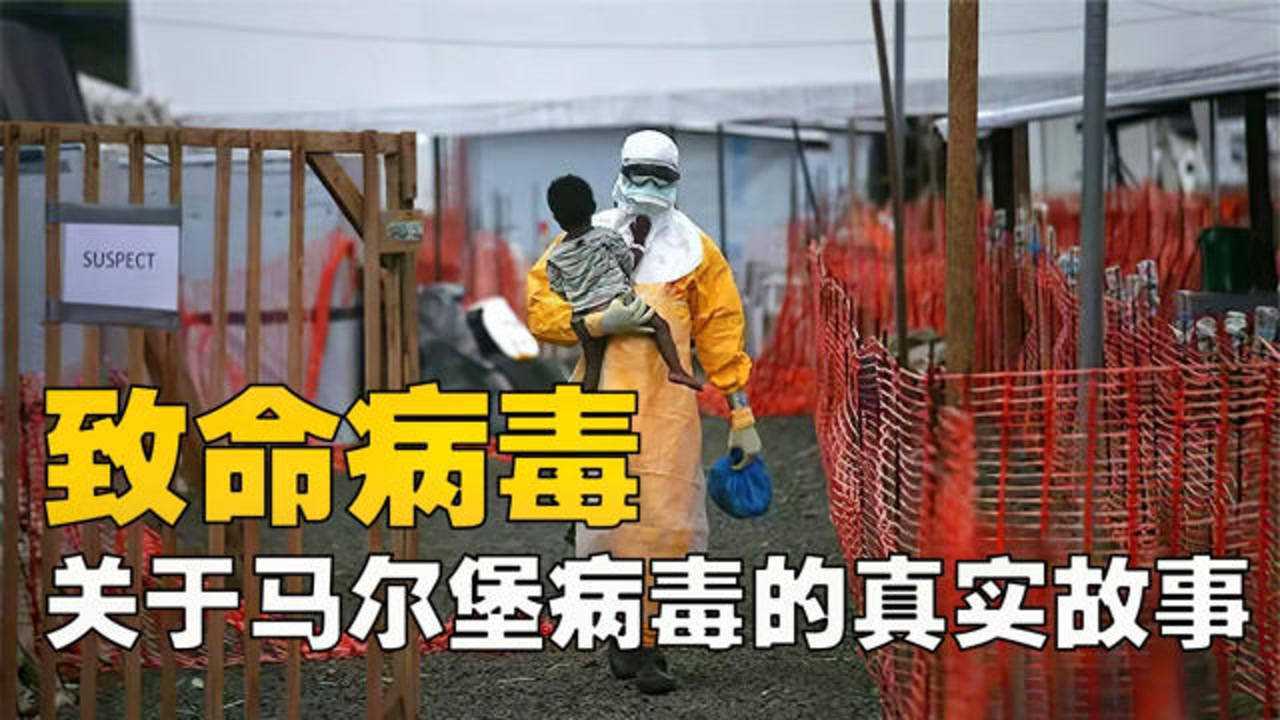 致命的四级病毒之一,马尔堡病毒!