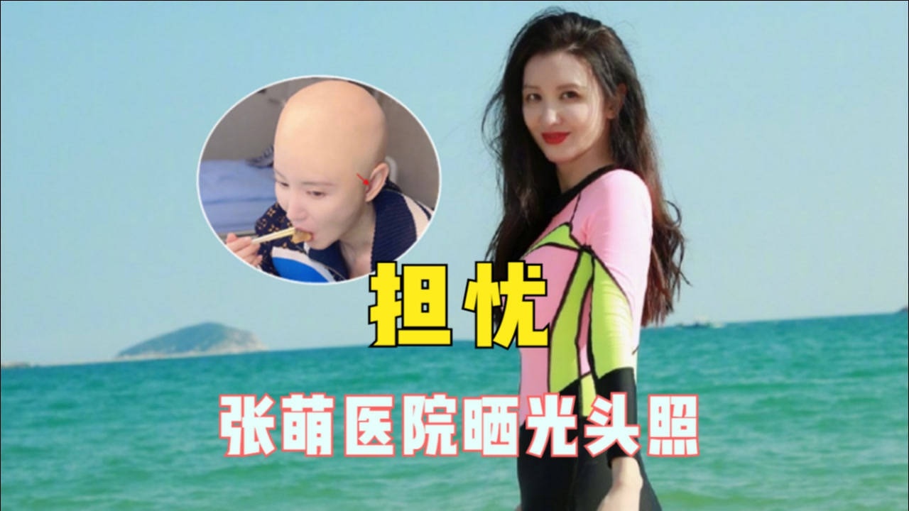 张萌医院晒光头照自侃龙抬头人家剪发我光头颜值耐打依旧很美