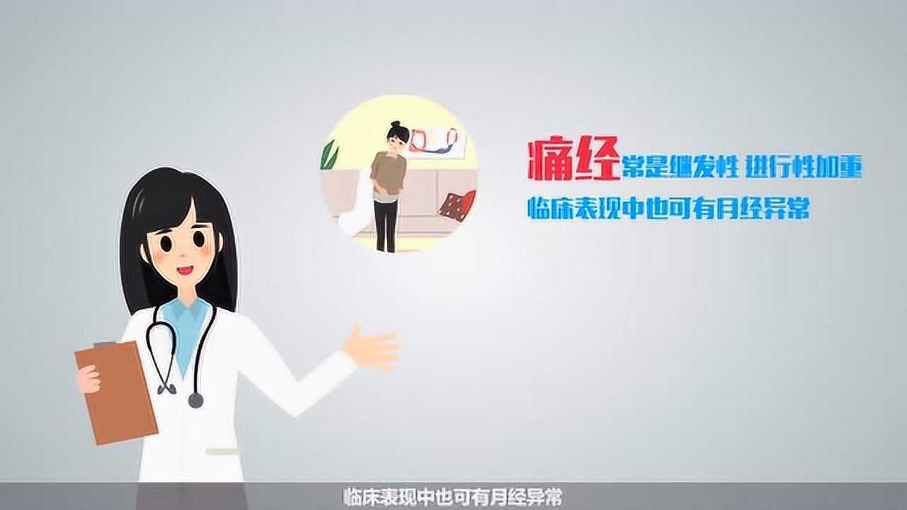 子宫内膜异位症科普视频_高清