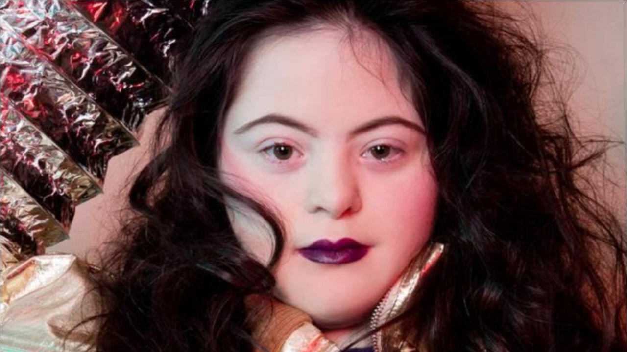 唐氏综合征小美女小时候没有被妈妈放弃长大成为美国顶级模特