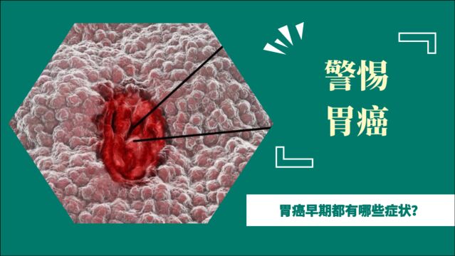 有种胃痛或在“暗示”胃癌,与普通胃痛有区别,不妨了解