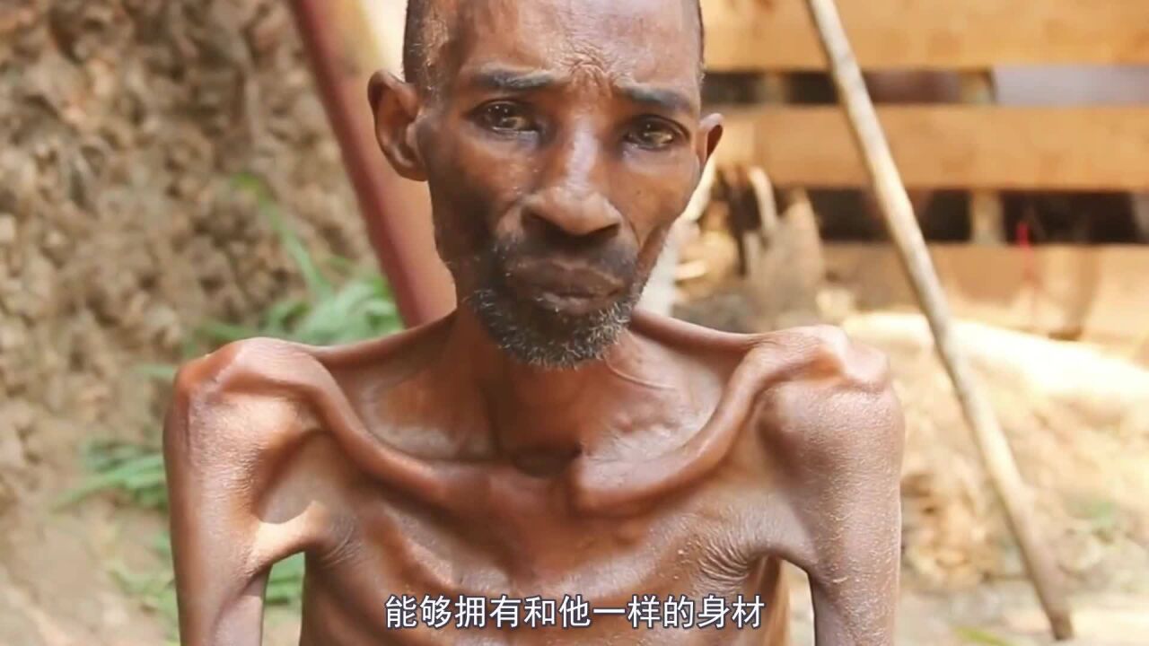 非洲一位堂堂七尺男兒,竟然瘦得只剩骨頭,彷彿一具移動的乾屍