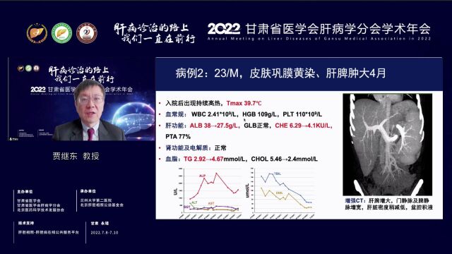 贾继东教授:血液系统疾病的肝脏表现