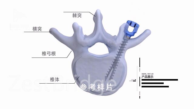 医学骨骼钉子