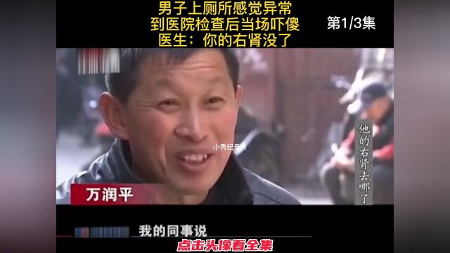 男子上厕所感觉异常,到医院检查后当场吓傻,医生:你的右肾没了#纪实#纪录片#奇闻 1