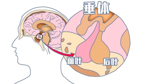 垂体—内分泌中的“老大哥”,垂体瘤虽小,危害却很大