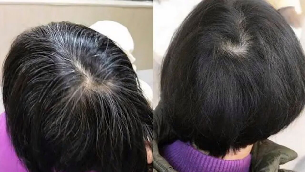 白发变黑发?假中医靠“白转黑”套路诈骗1400余万,大量诈骗话术曝光_高清1080P在线观看平台_腾讯视频