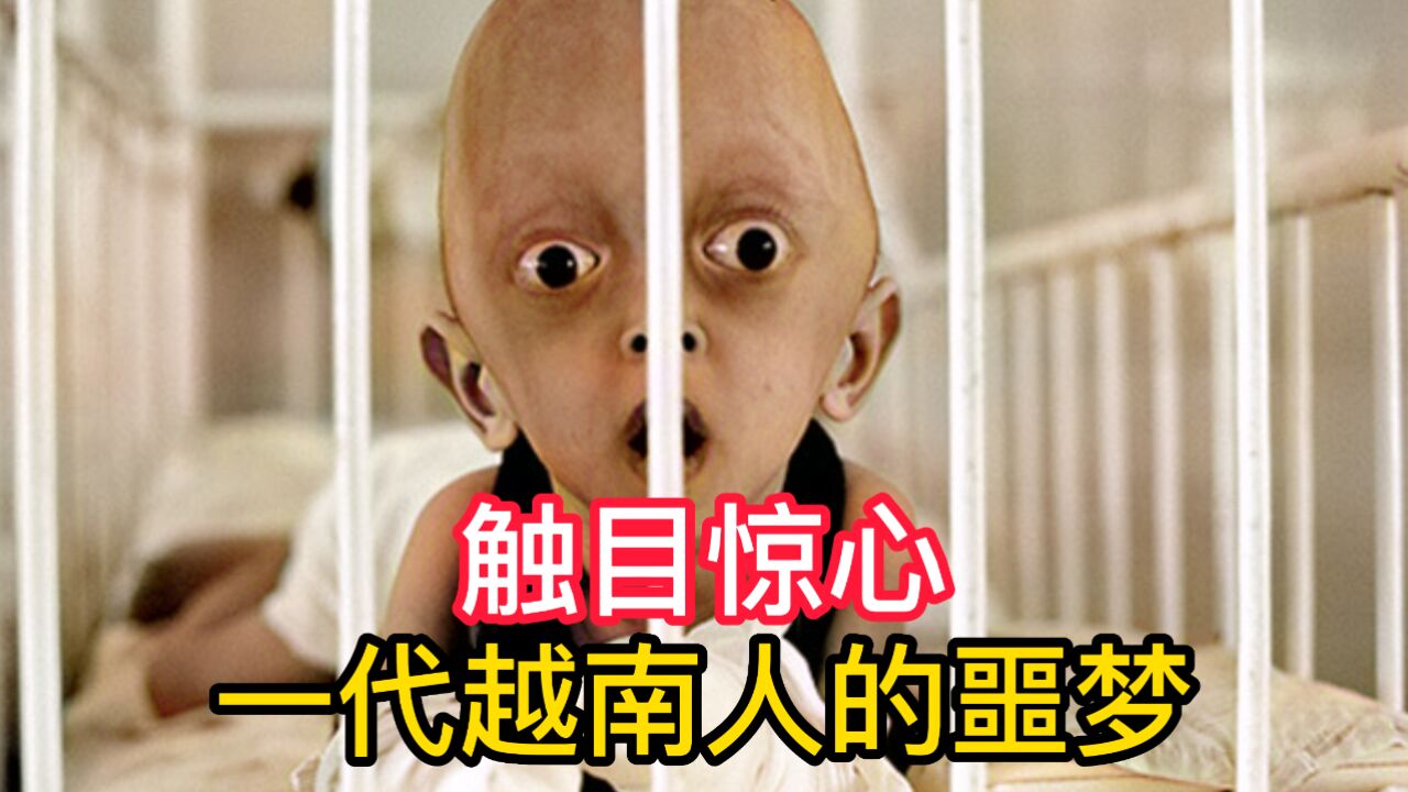 橙剂后遗症威力无穷，一代越南人的噩梦，我表示：触目惊心！_高清1080P在线观看平台_腾讯视频