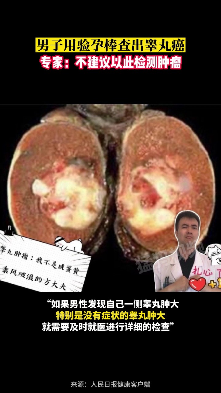 阴囊癌晚期症状图片图片