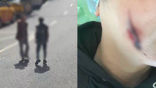 重庆通报“农业执法人员持菜刀伤人”：警方已受案 正组织伤情鉴定
