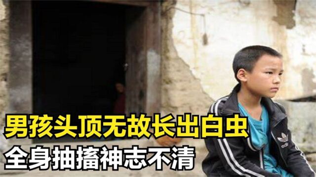 贵州男孩头顶无故长出白虫,全身抽搐神志不清,真相却令众人吃惊